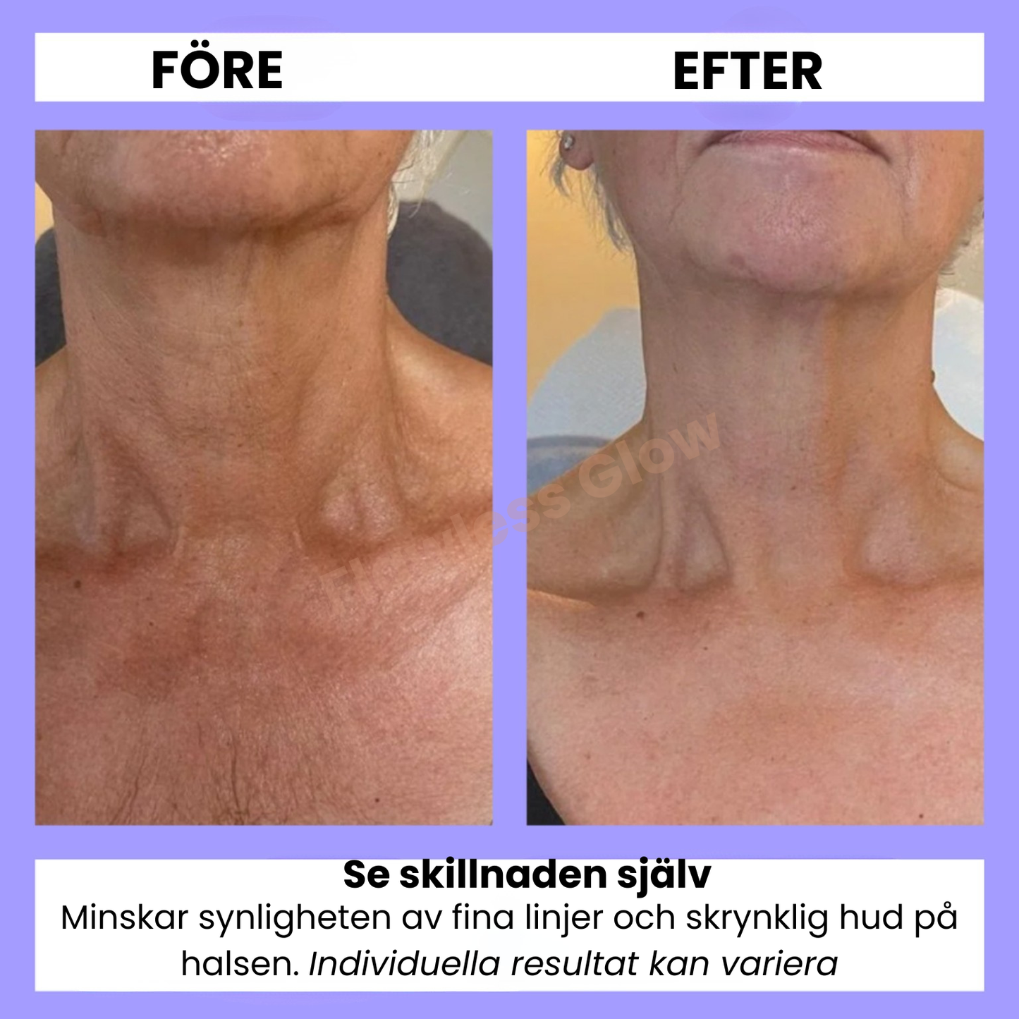 GlowLift™ Firming Neck Cream